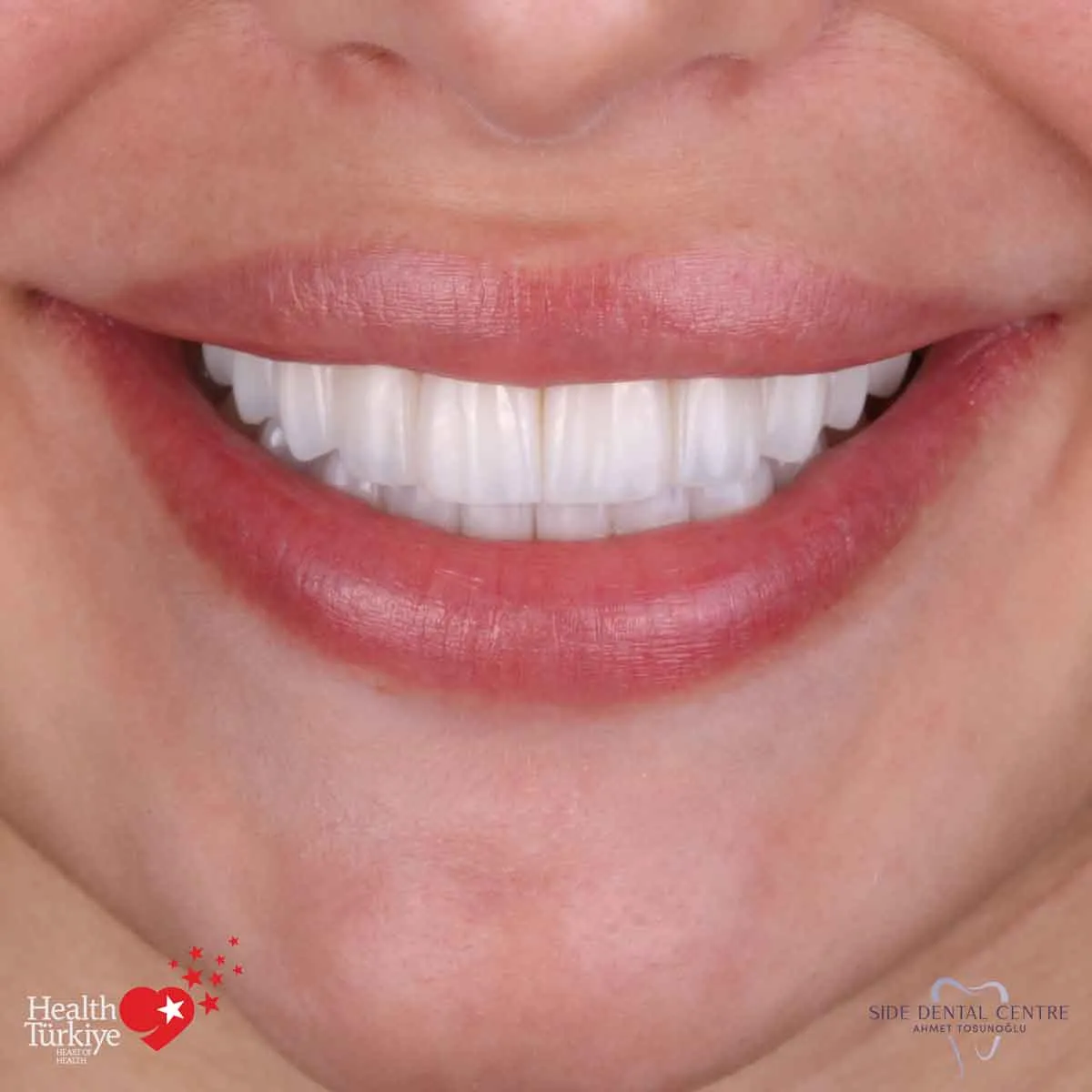 Pacjent Side Dental Centre